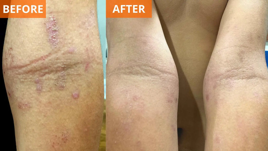 Moisturizing Skin Cream (Shopify Collective)