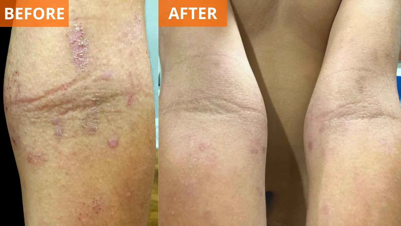 Moisturizing Skin Cream (Shopify Collective)